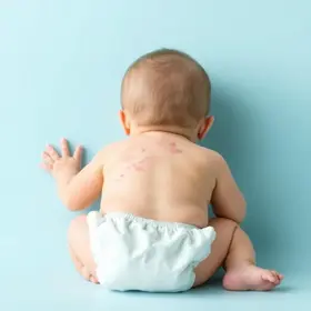 Pomada para assadura como escolher: Guia Completo para Mães e Famílias