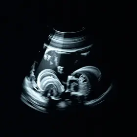Ultrassom obstétrico perto de mim: Como Encontrar e Avaliar Opções Próximas