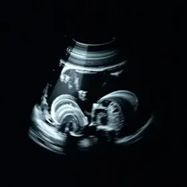 Ultrassom obstétrico perto de mim: Como Encontrar e Avaliar Opções Próximas